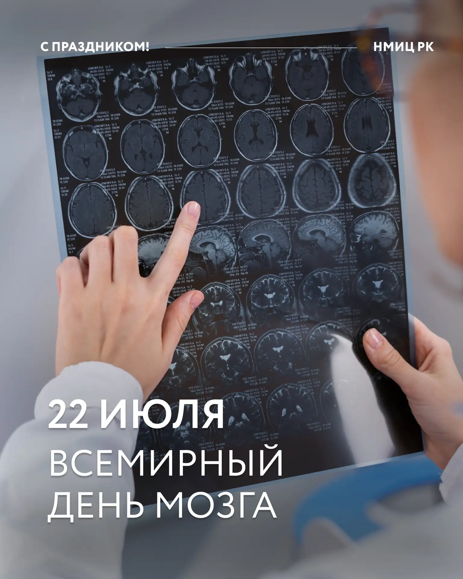 🧠 День мозга: прокачайте его прямо сейчас с помощью простых упражнений

Мозг — наш главный процессо
