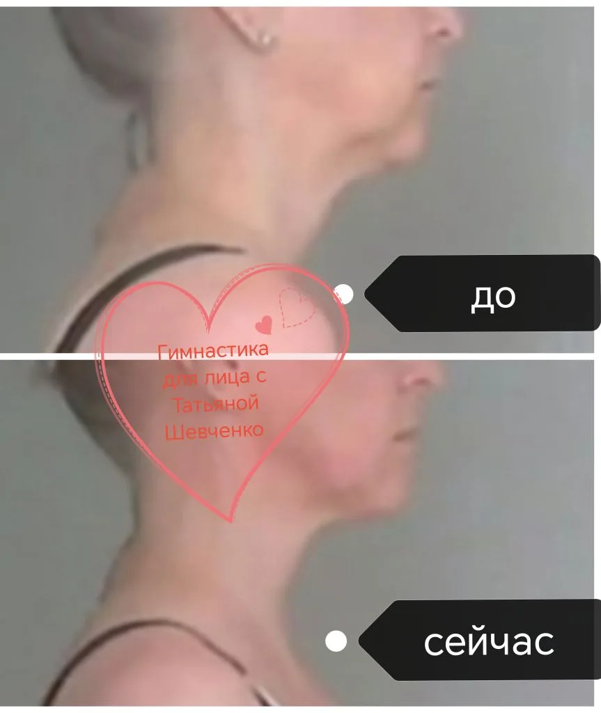 Почему лицо «плывет», а дорогие процедуры не помогают? История Марины