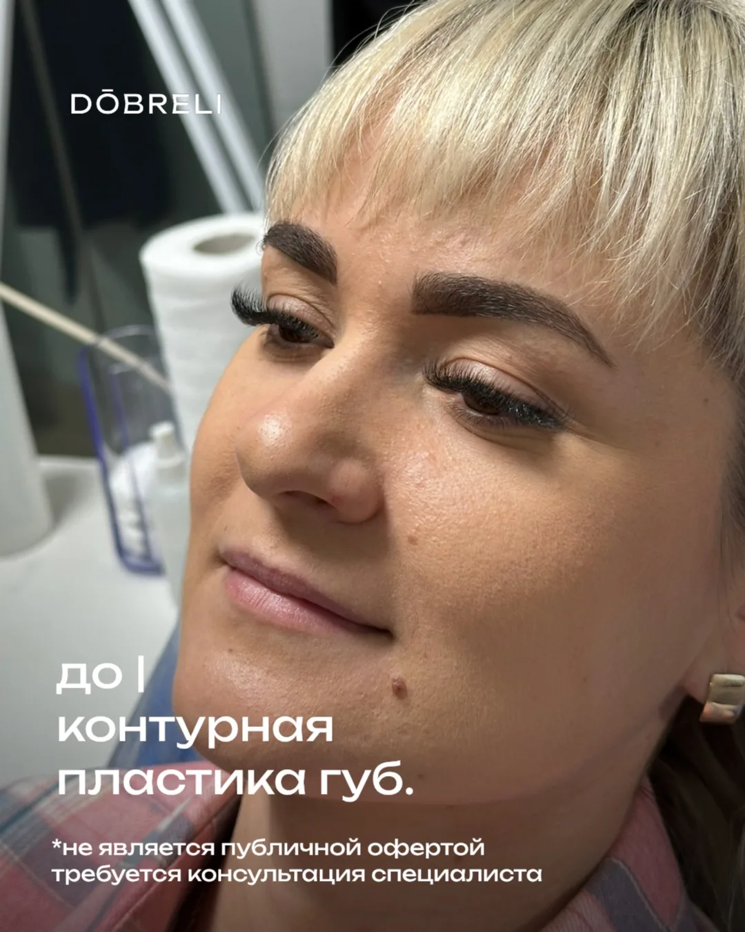 Идеальные губы — это не про «больше», это про гармонию.