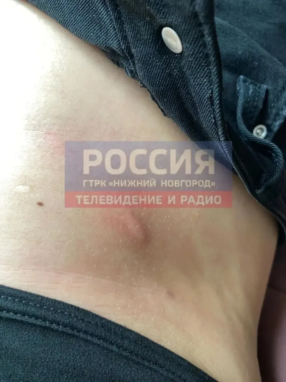 ❗️Доберман укусил девушку в ЖК «Седьмое небо»
