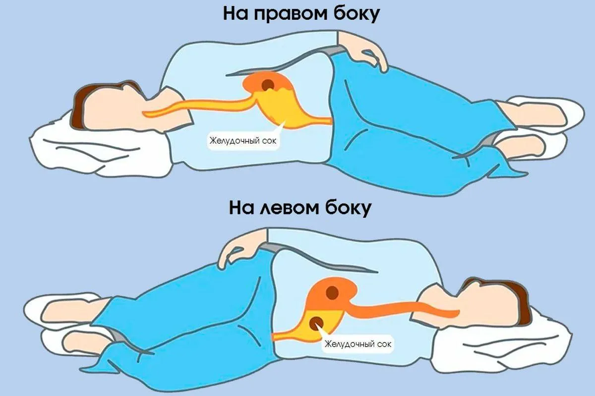 А вы знаете, в чем польза сна на левом боку? 👇
⠀⠀
✅ Облегчение изжоги 
Если после острой и обильной