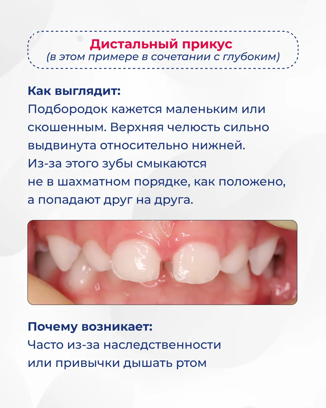 Листайте карусель ➡️  Заметили у своего ребенка один из этих признаков? Запишитесь на консультацию к