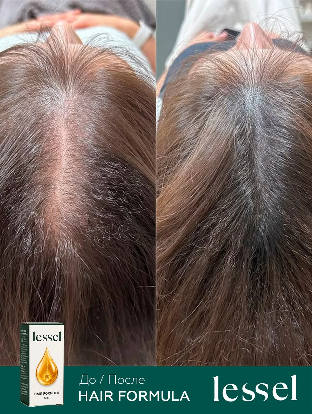Результат работы препарата HAIR FORMULA