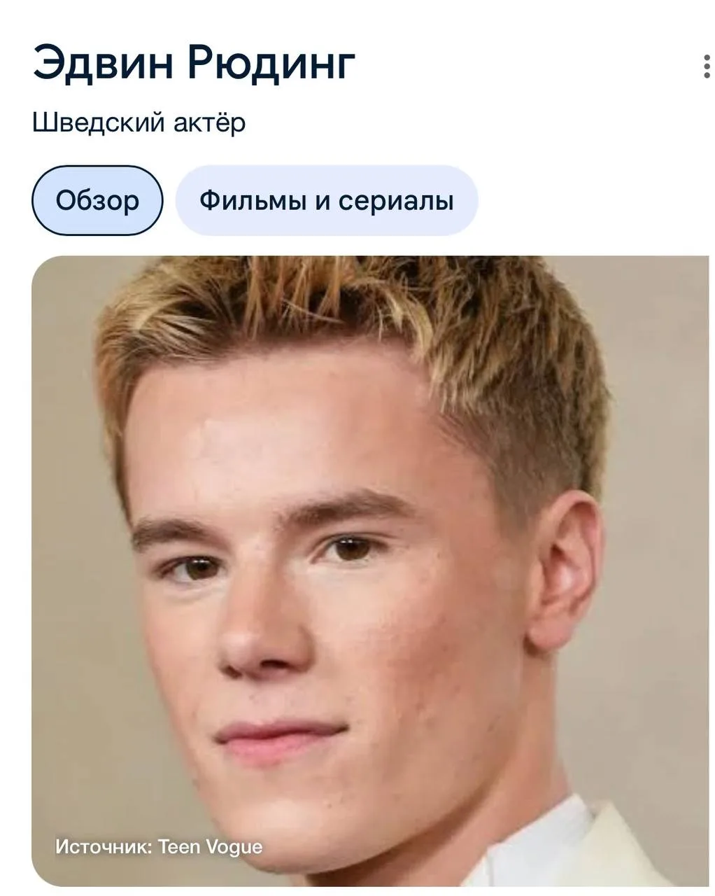Второй мальчик шведский актер Эдван Рюдинг )

Я такого не знаю, мне просто сказали, что похож, я заг