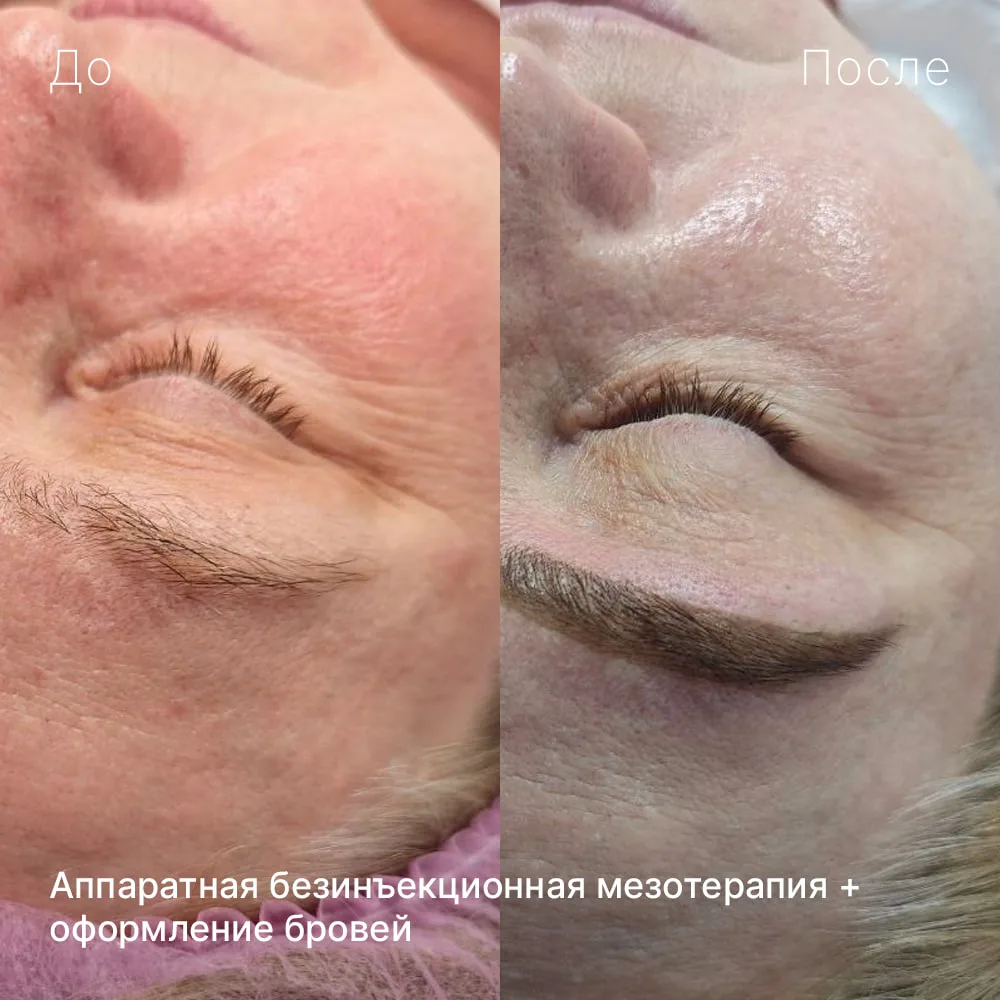 ⚡️ новый результат в портфолио! ⚡️