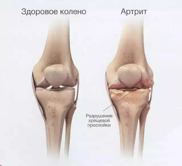 УЗИ суставов Бесплатно в Ставрополе