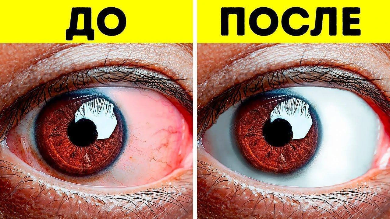 ❗️ ЗРЕНИЕ ВОЗВРАЩАЕТСЯ В ЛЮБОМ ВОЗРАСТЕ