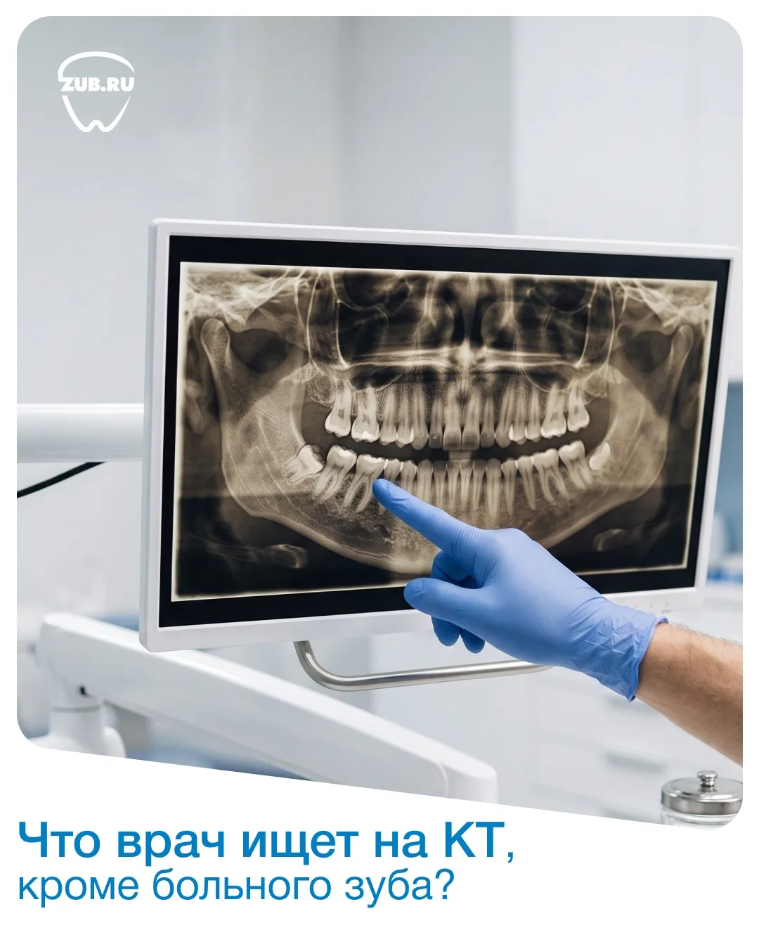 Что именно врач может заметить на 3D-снимке и почему КТ важно для точной диагностики?
