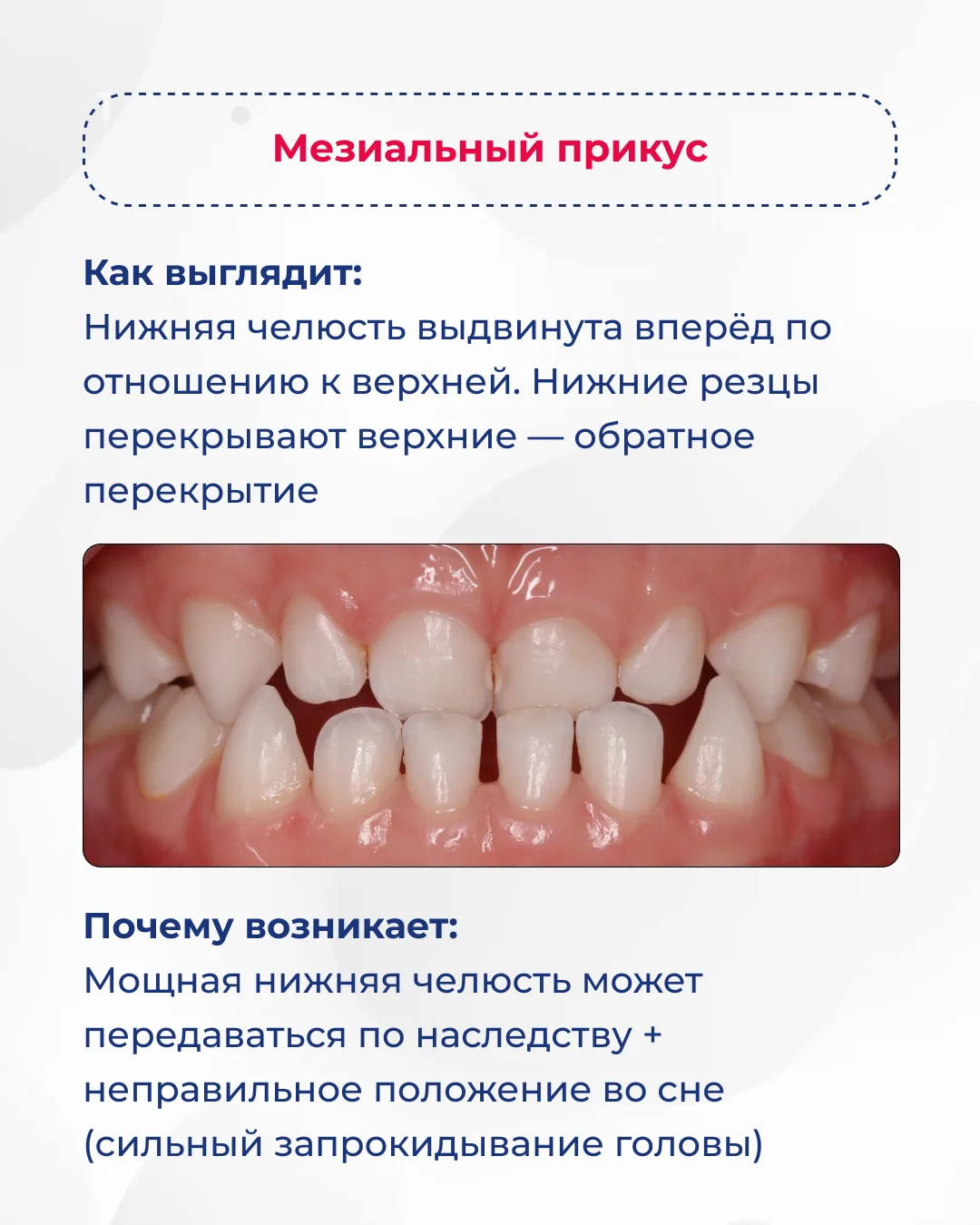 Листайте карусель ➡️  Заметили у своего ребенка один из этих признаков? Запишитесь на консультацию к