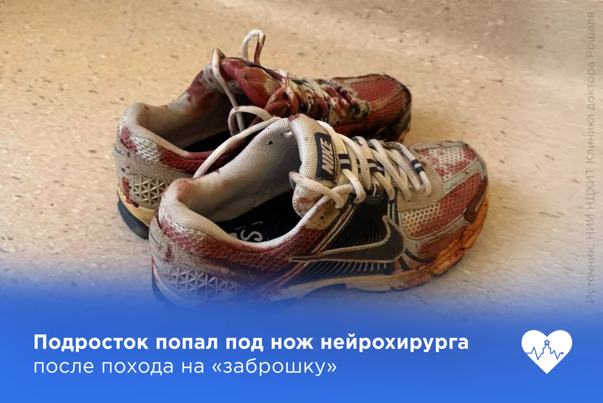 Подросток попал под нож нейрохирурга после похода на «заброшку» 😱