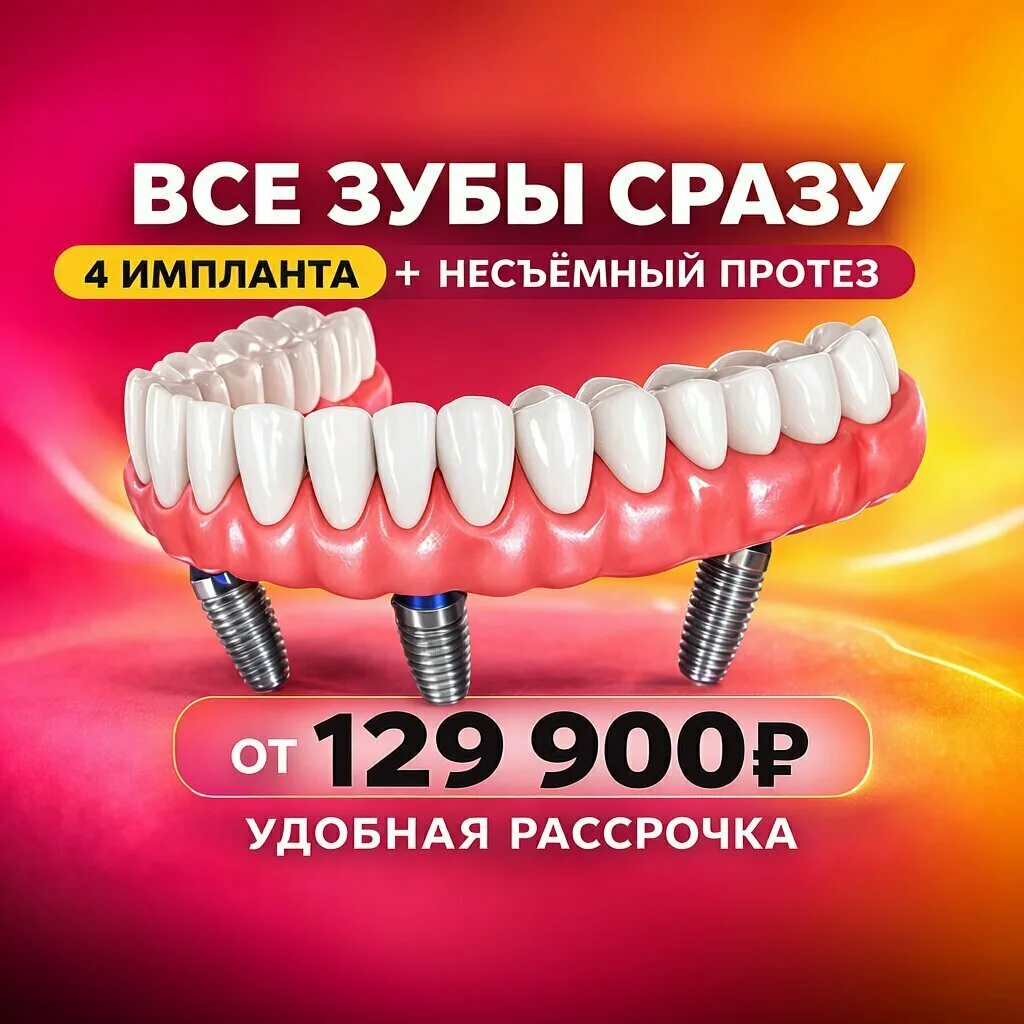 Несъёмное протезирование на 4-х имплантах в Тольятти.