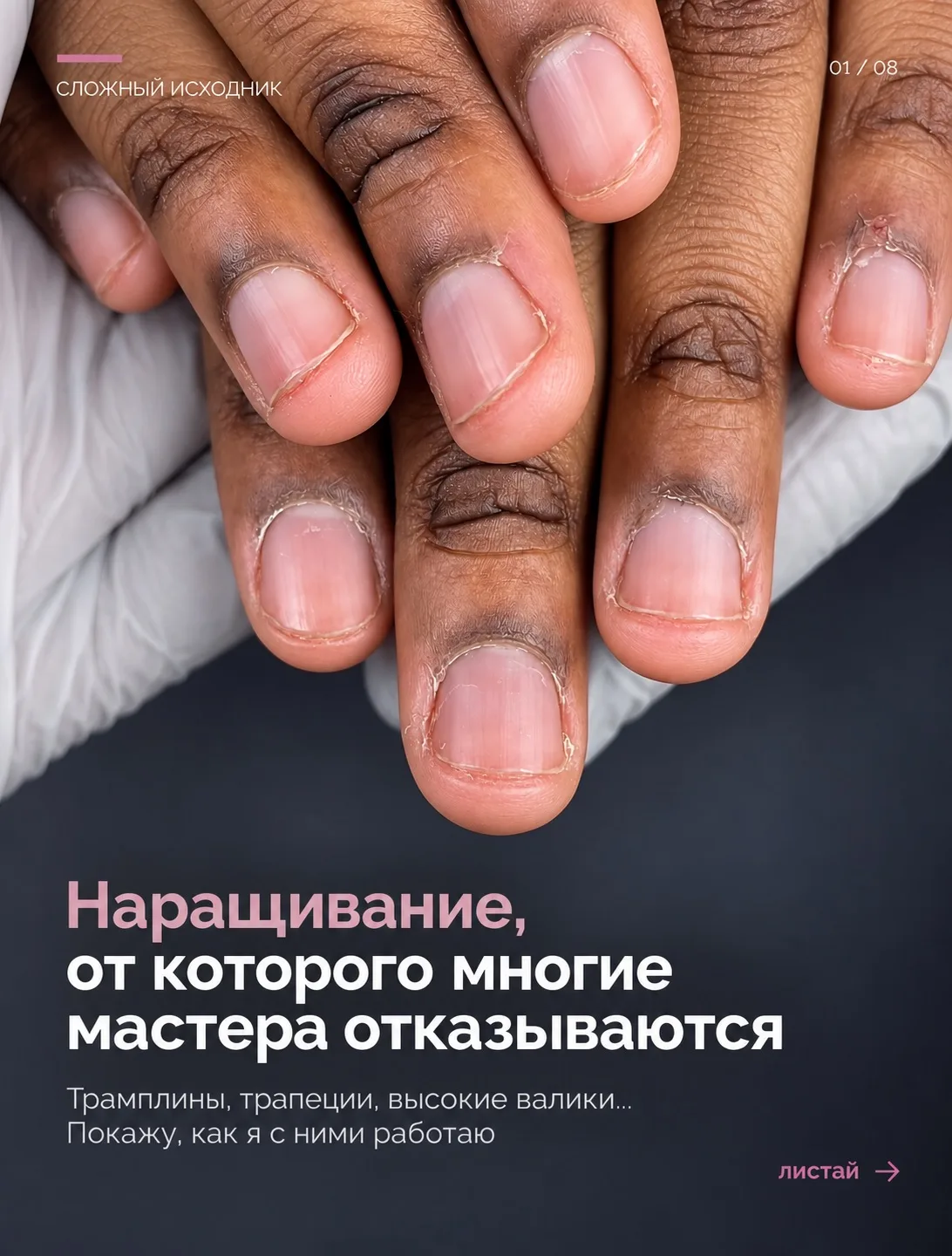 Трамплины — исправлять или просто выравнивать? 🤔