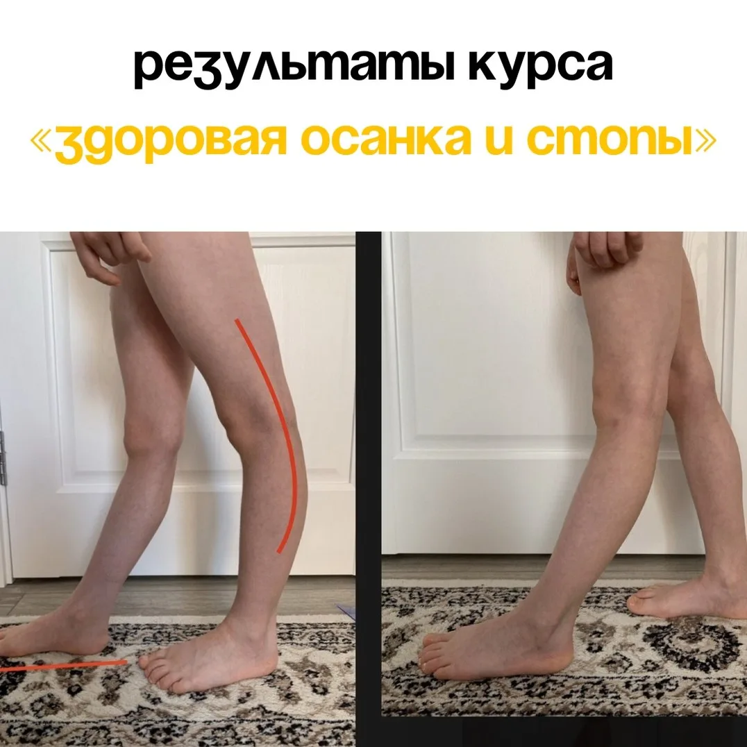 «Мы же занимаемся спортом, у нас не может быть плохой осанки»  С таким заблуждением сталкиваются мно