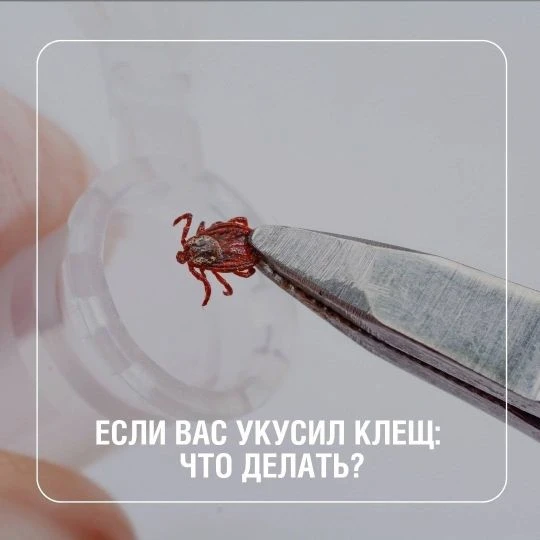 Обнаружили клеща после прогулки в парке или на природе?
Не паникуйте – действуйте пошагово.
Шаг 1. А