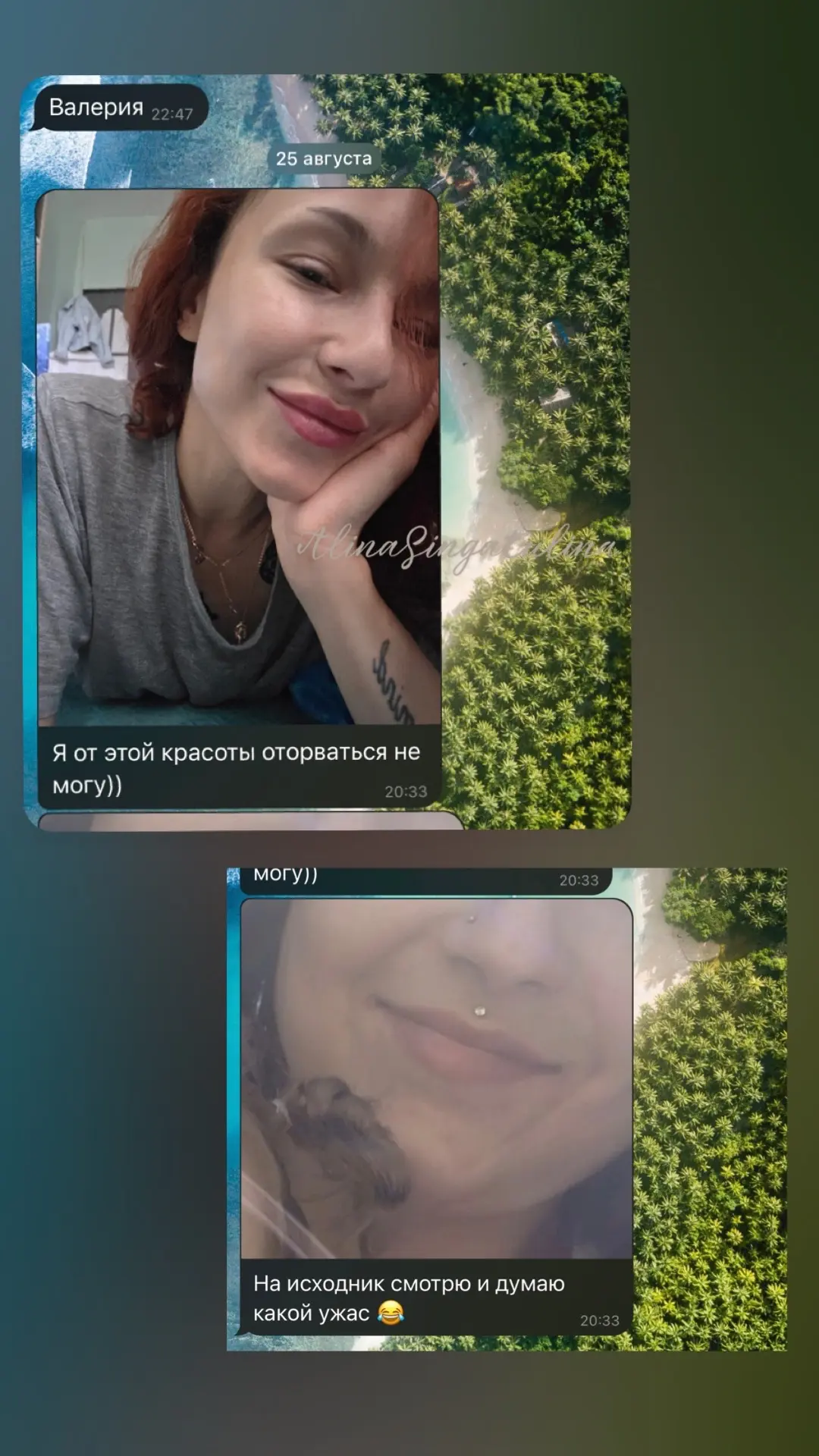 🖤🖤🖤 отзыв после увеличения губ