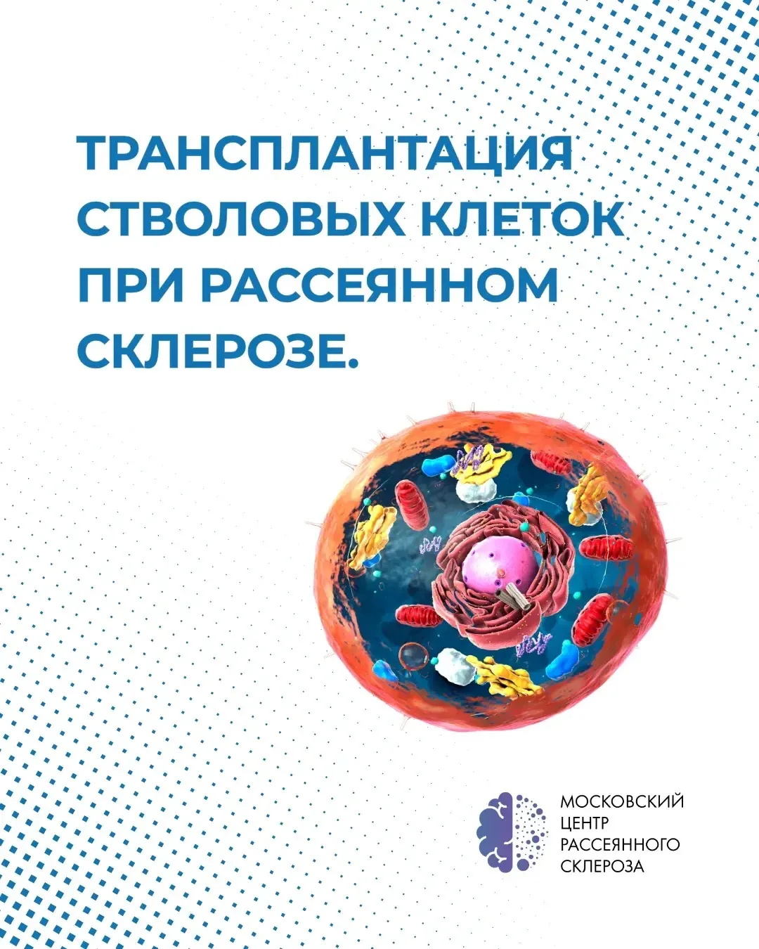 Трансплантация стволовых клеток при рассеянном склерозе. Что на самом деле работает?

Многие слышали