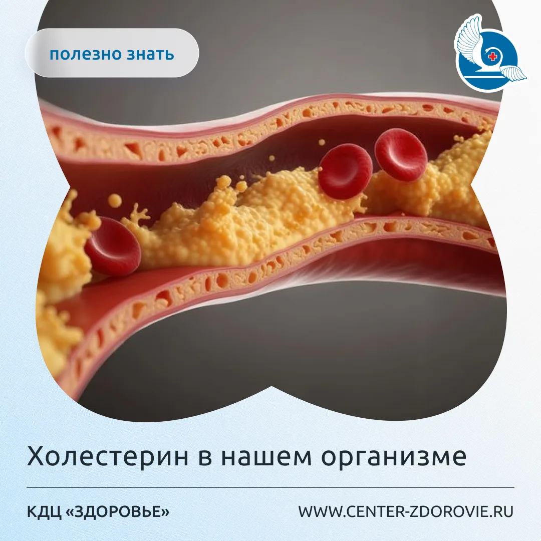 Холестерин в нашем организме.