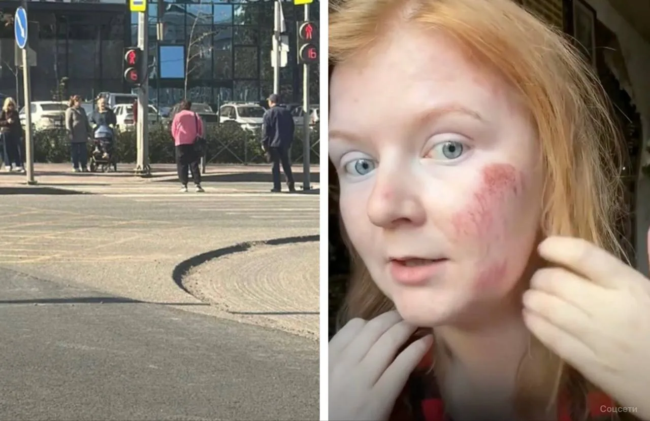 😡 Пермячка ободрала лицо, запнувшись об асфальт во время ремонта в центре города