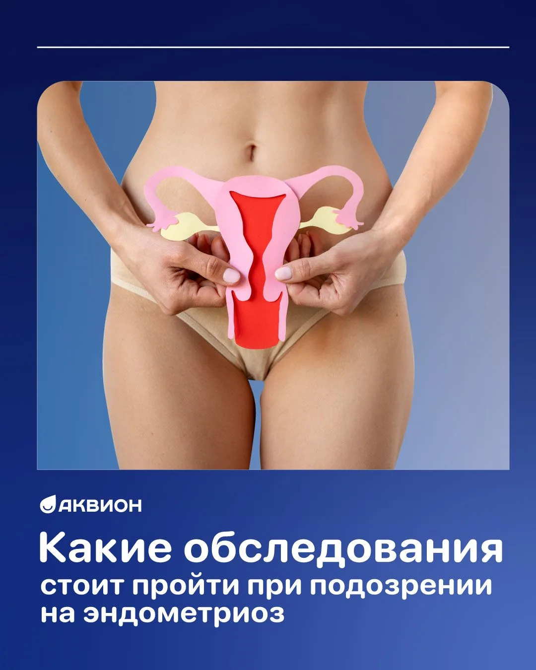📌Какие обследования стоит пройти при подозрении на эндометриоз
   
Первый шаг – гинекологический ос