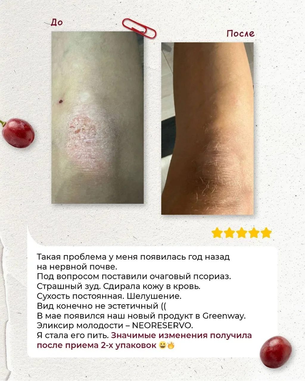 РЕАЛЬНЫЕ ИЗМЕНЕНИЯ С NEORESERVO🍀  Мы собрали ваши отзывы о нашем флагмане🍀, и тут правда есть на что