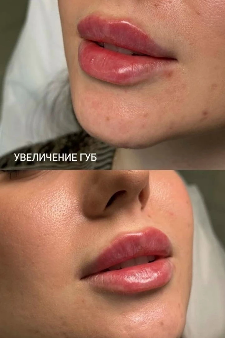 👩‍⚕ Врач-косметолог | Высшее медицинское образование