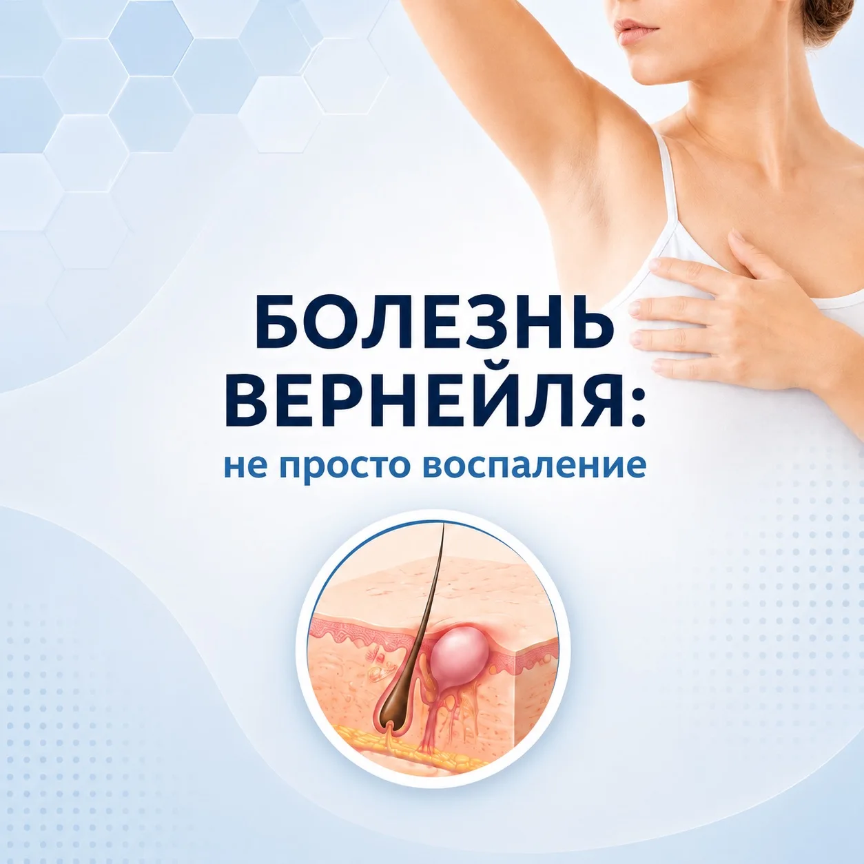 Болезнь Вернейля: не просто воспаление