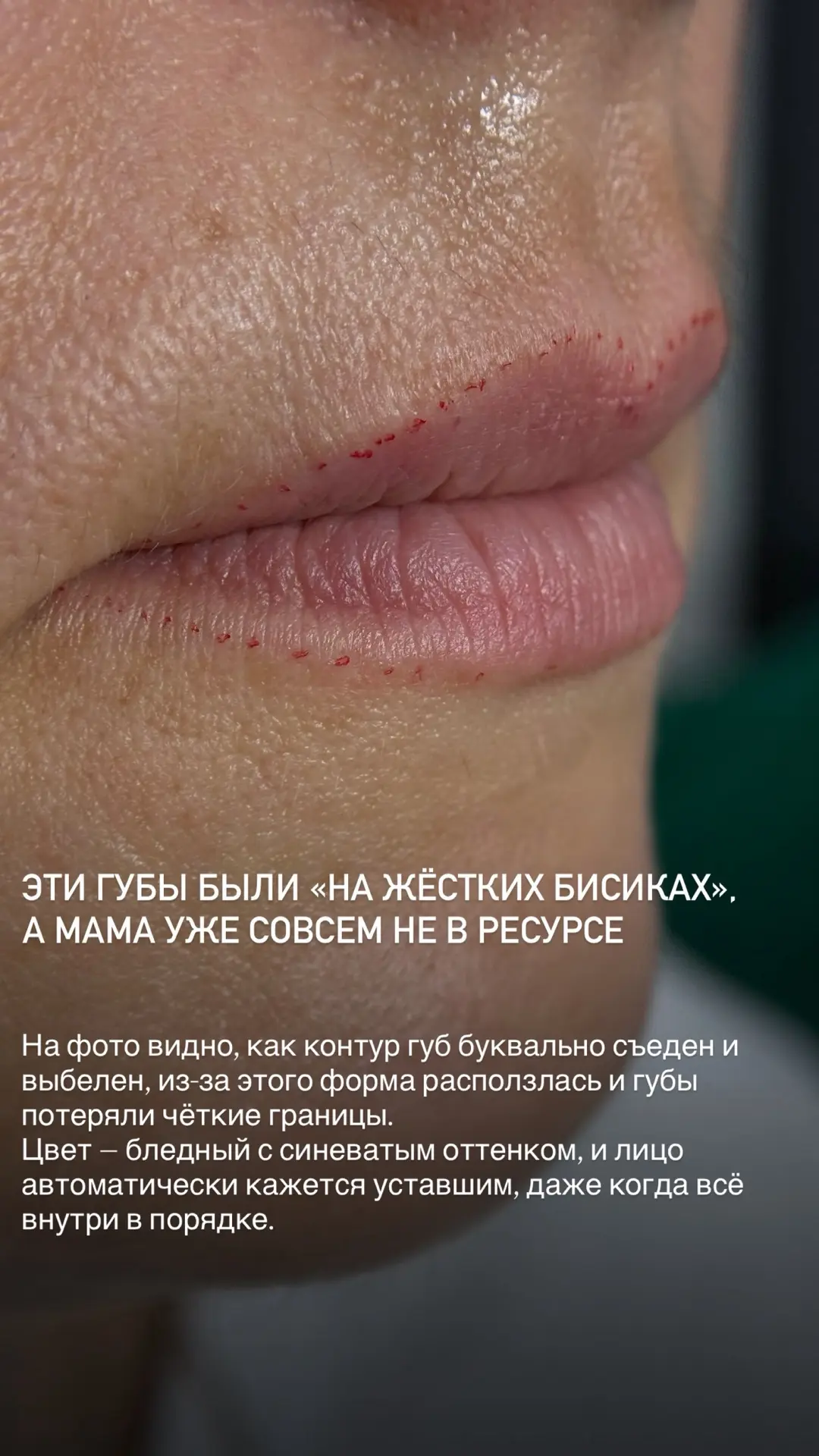 Малыш, ты не в курсе… эти губы тоже были «на жёстких бизиках», а мама уже совсем не в р...