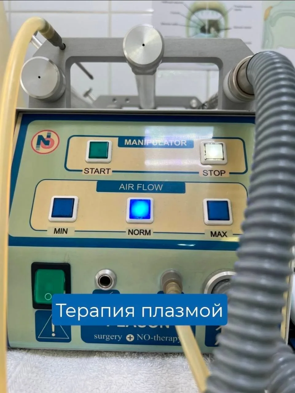 Холодная плазма - оружие будущего против инфекцией.