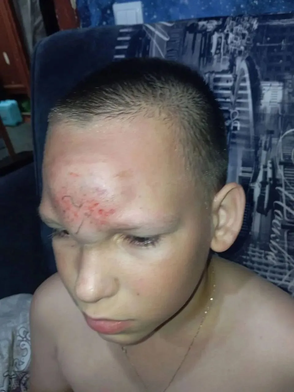 🤬 Жесть из небольшого поселка Юганец под Дзержинском — 11-летний мальчик получил удар кирпичом по г