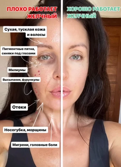🍂ВАШ ЖЕЛЧНЫЙ НЕ РАБОТАЕТ🍂