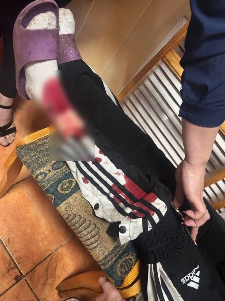 Агрессивные псы напали на подростка в Бугульме 
 
Все произошло в поселке на Тепловозном переулке. Ж