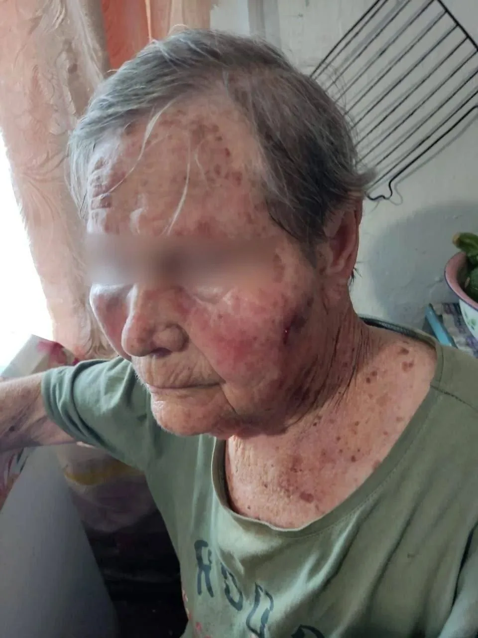 Вдову ветерана ВОВ избили из-за доли в доме в Приморье.