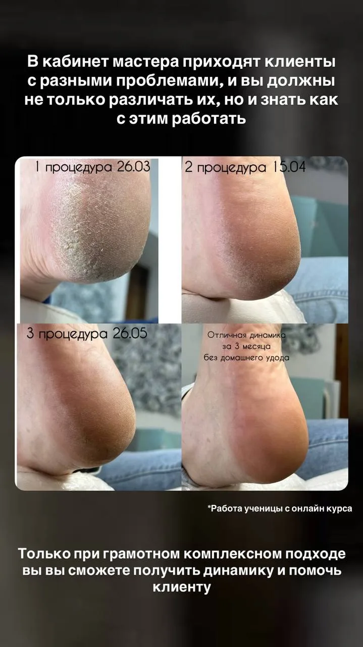 Уже 22 июня, старт продаж нового обновленного онлайн курса «ТОП МАСТЕР👣»