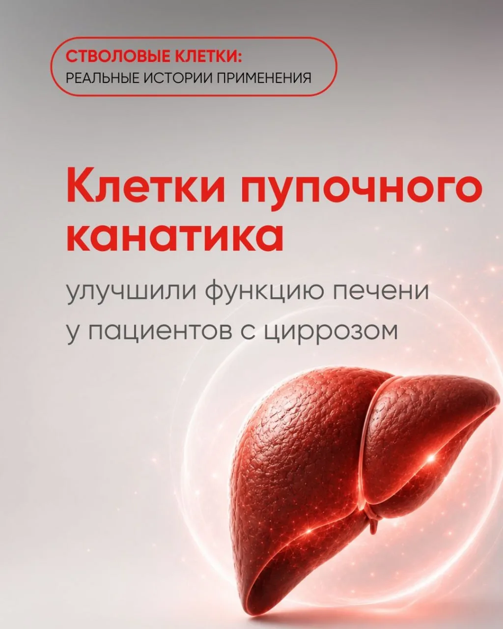 Клетки пупочного канатика улучшили функцию печени у пациентов с декомпенсированным цирр...