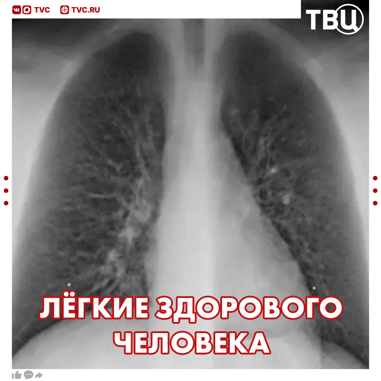 Легкие частично отказали у 19-летнего парня из Саратовской области из-за вейпа  Парень пять лет кури