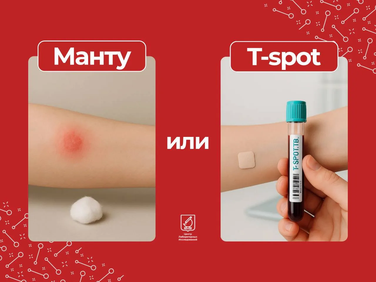 Туберкулез не исчез, и он по-прежнему труден в терапии.