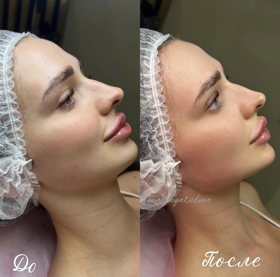 Моделирование овала лица ✨