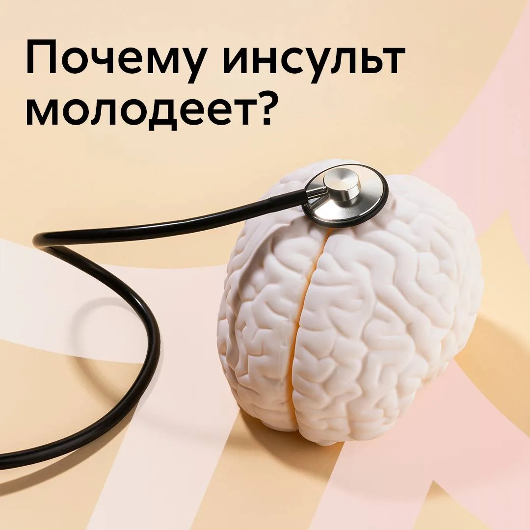 Почему инсульт перестал быть болезнью пожилых?   Тревожный тренд Еще 20 лет назад инсульт у 30–40-ле