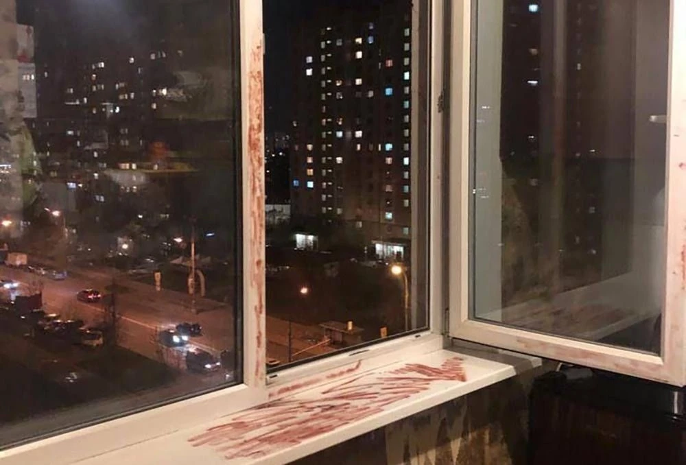 😱😱В Башкирии девочка выпала из окна квартиры на 4 этаже