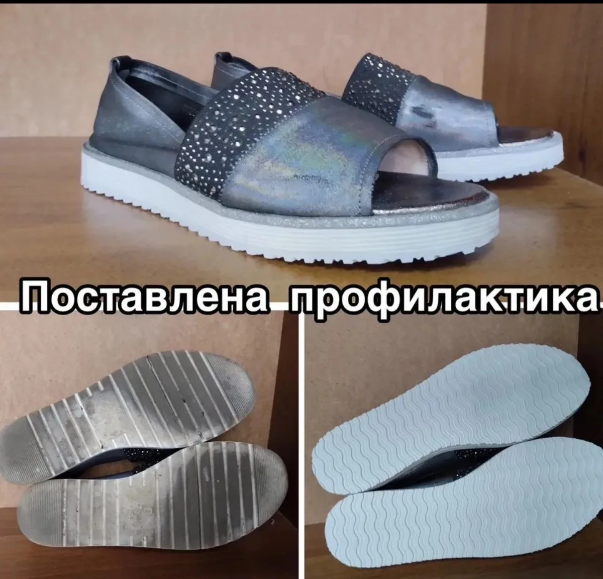 Ремонт перелома подошвы