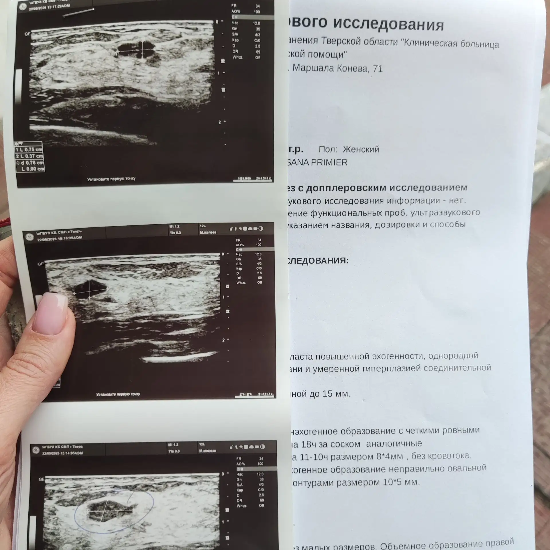 Я как ответственный пациент все прохожу и не пропускаю☝