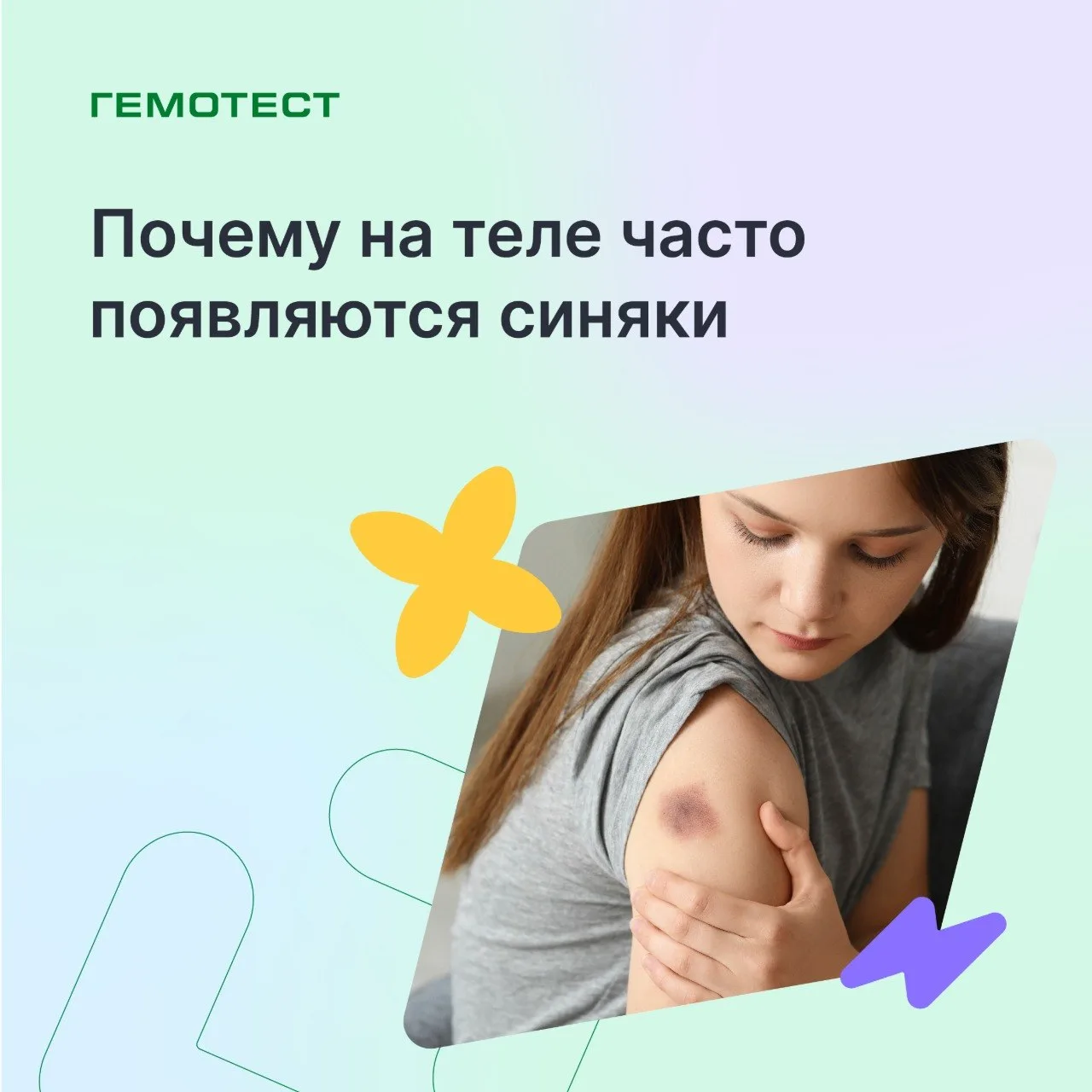 🔘 Почему на теле часто появляются синяки