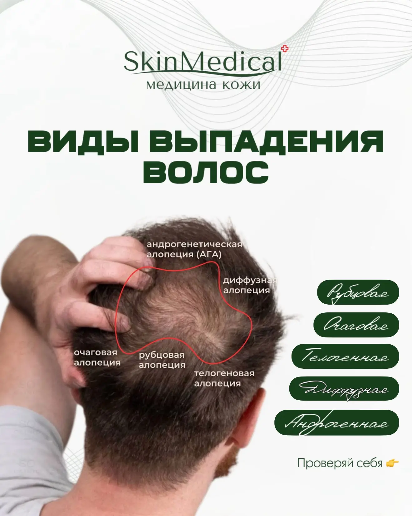Не каждое выпадение волос одинаковое. И чтобы остановить проблему, важно сначала понять ее причину.
