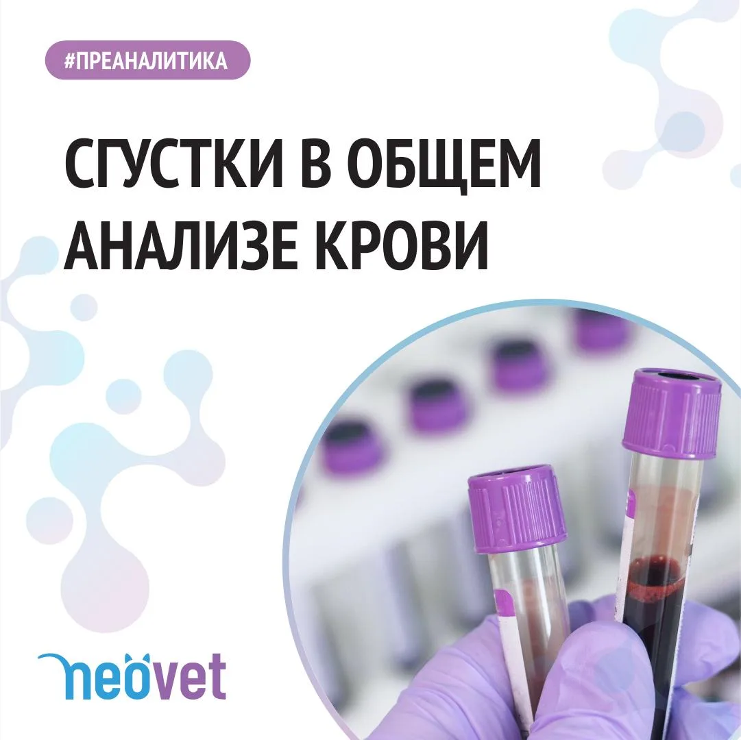 #преаналитика