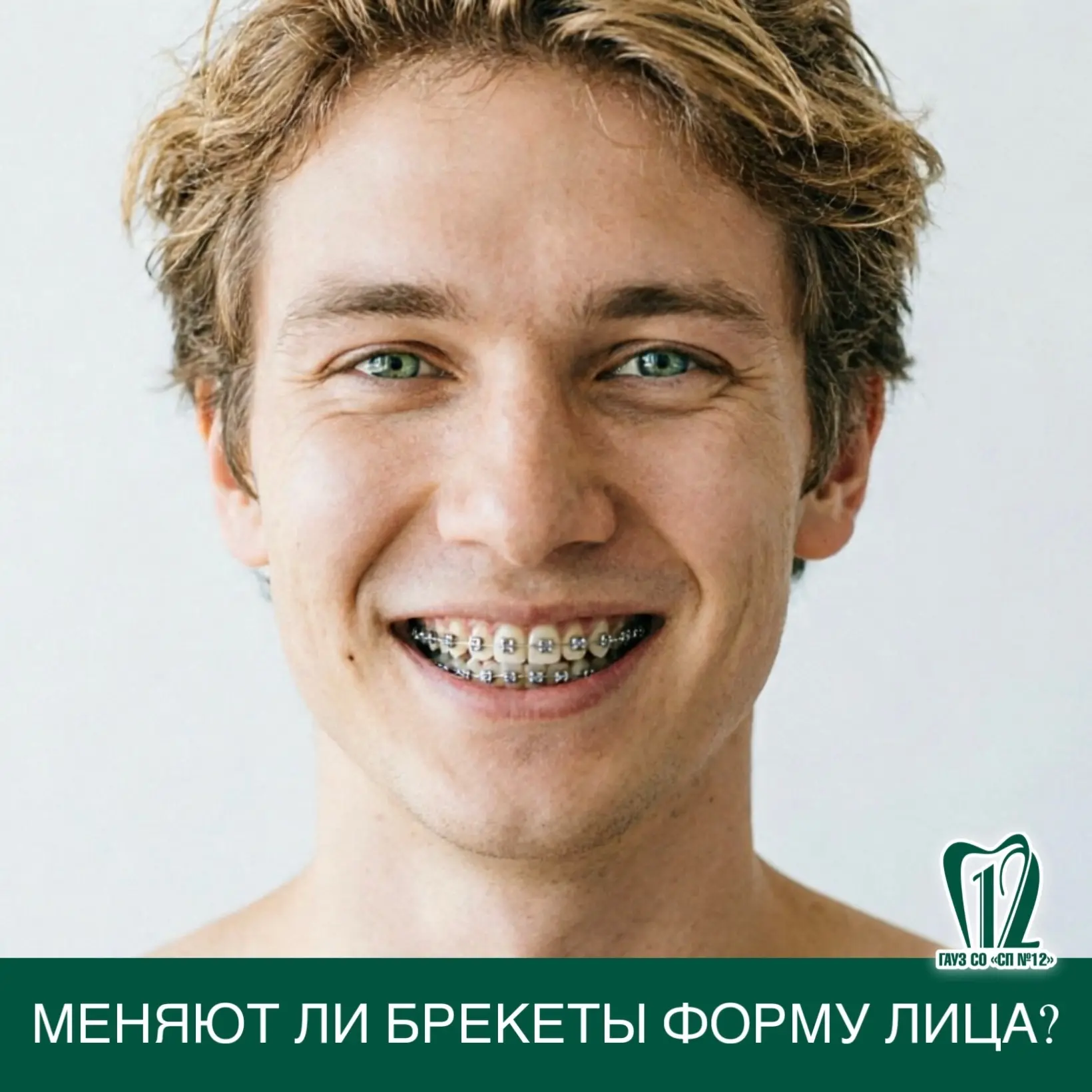 Меняют ли брекеты форму лица?