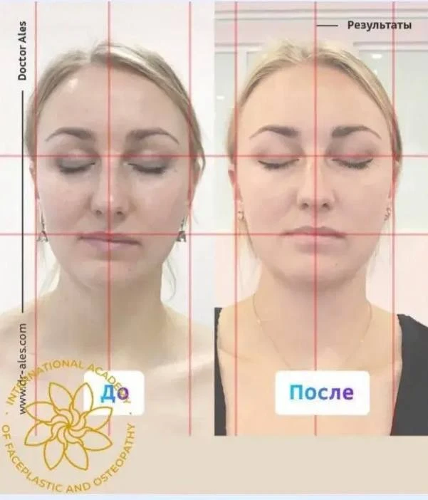 🎁 Замечаете, что одна сторона лица выглядит иначе, чем другая?

Один глаз кажется меньше, уголок гу