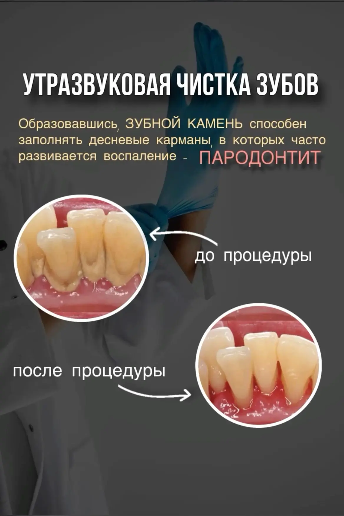 ❗️АКЦИЯ❗️
Профессиональная чистка Зубов ВСЕГО за 2 500 рублей!
Успевайте записаться ✨