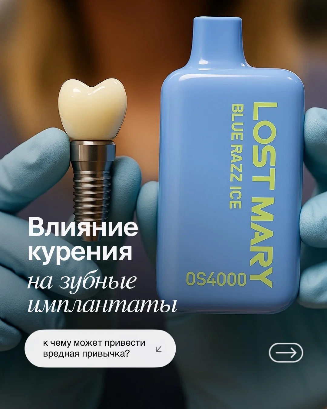 📌 ВЛИЯНИЕ КУРЕНИЯ НА ЗУБНЫЕ ИМПЛАНТАТЫ