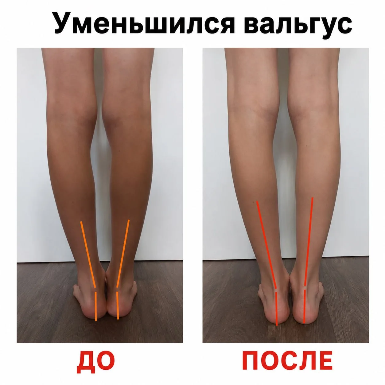 «Он начал сам следить за своей осанкой - без моих напоминаний!» - с восторгом поделилась с нами мама