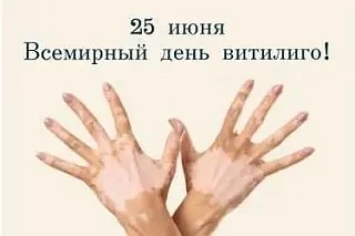 25 июня - Всемирный день витилиго 🧬

Это заболевание встречается у 1–3% населения России, причём в 